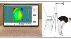 AI“頭脳”と3Dの“目”で服を着たままの側弯症検診が可能に 「SCOLIOMAP脊柱側弯モニタ」の開発・社会実装を実現