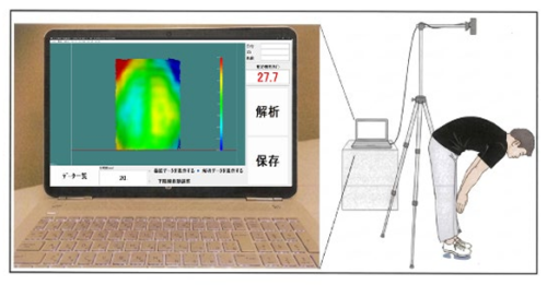 AI“頭脳”と3Dの“目”で服を着たままの側弯症検診が可能に 「SCOLIOMAP脊柱側弯モニタ」の開発・社会実装を実現 AI“頭脳”と3Dの“目”で服を着たままの側弯症検診が可能に 「SCOLIOMAP脊柱側弯モニタ」の開発・社会実装を実現