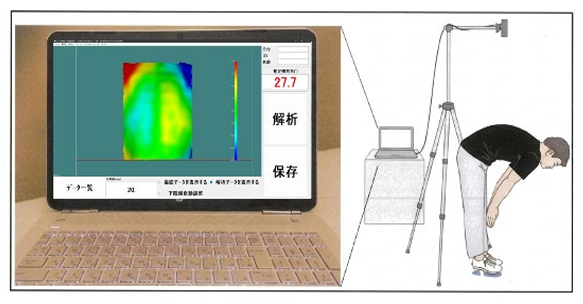 AI“頭脳”と3Dの“目”で服を着たままの側弯症検診が可能に 「SCOLIOMAP脊柱側弯モニタ」の開発・社会実装を実現