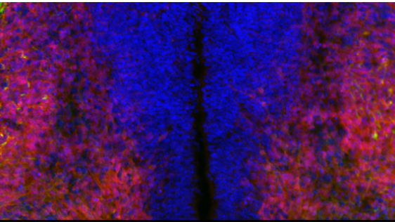 神経回路形成の発見が脊髄損傷・脳卒中治療への道を開く可能性（Discovery on neural wiring could unlock paths toward treatment of spinal cord injury, stroke）