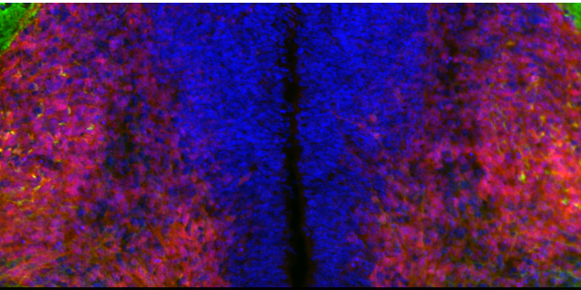 神経回路形成の発見が脊髄損傷・脳卒中治療への道を開く可能性（Discovery on neural wiring could unlock paths toward treatment of spinal cord injury, stroke）