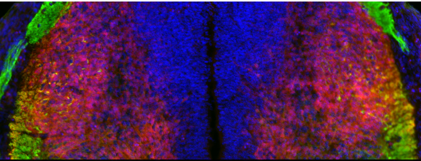 神経回路形成の発見が脊髄損傷・脳卒中治療への道を開く可能性(Discovery on neural wiring could unlock paths toward treatment of spinal cord injury, stroke) 神経回路形成の発見が脊髄損傷・脳卒中治療への道を開く可能性(Discovery on neural wiring could unlock paths toward treatment of spinal cord injury, stroke)