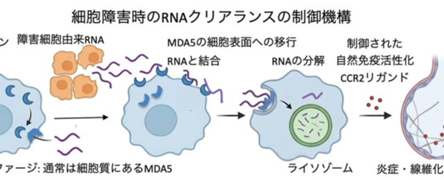 細胞外自己RNAを除去することによる炎症・線維化の制御 ――ウイルスRNAセンサーMDA5が間質性肺炎（肺線維症）を制御する仕組み―