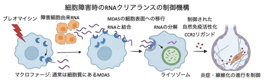 細胞外自己RNAを除去することによる炎症・線維化の制御 ――ウイルスRNAセンサーMDA5が間質性肺炎(肺線維症)を制御する仕組み― 細胞外自己RNAを除去することによる炎症・線維化の制御 ――ウイルスRNAセンサーMDA5が間質性肺炎(肺線維症)を制御する仕組み―